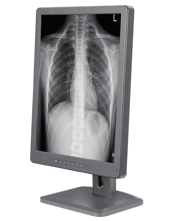 21.3英寸医疗诊断显示器